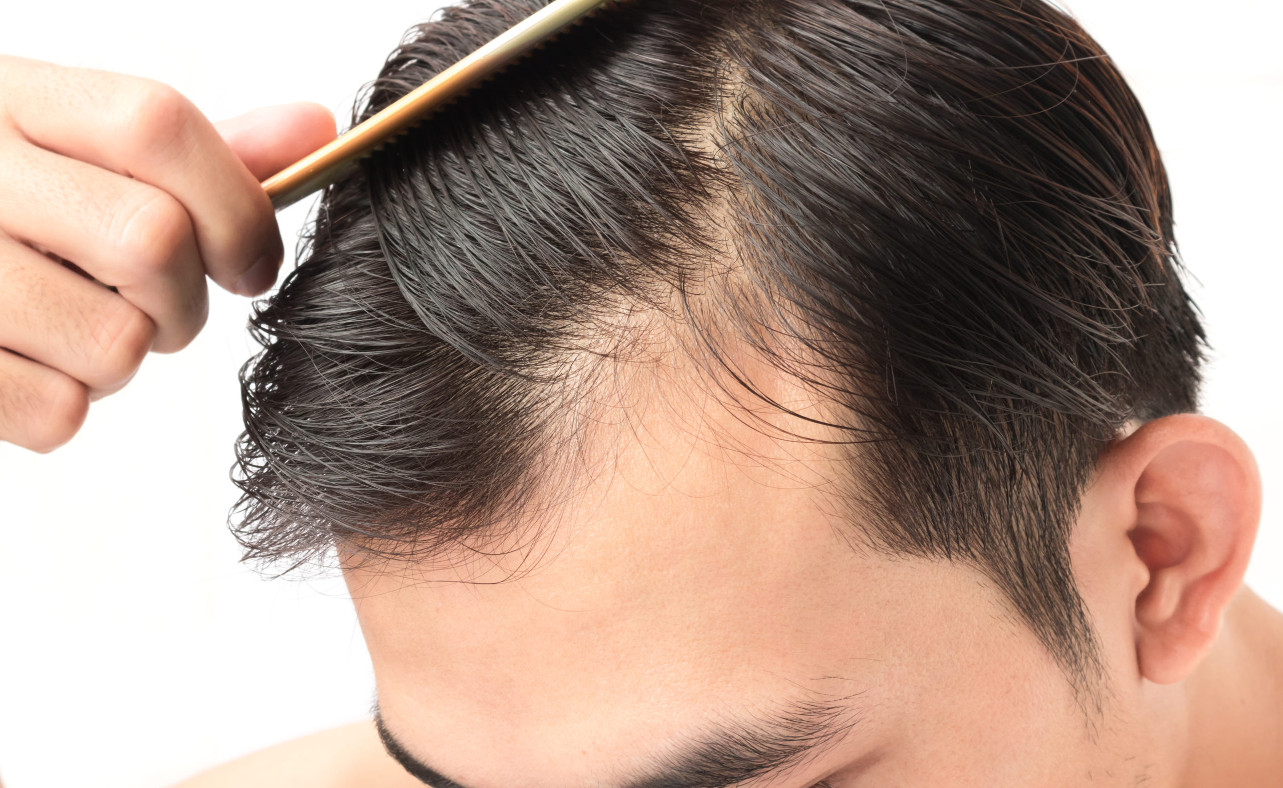 メンズにおすすめ育毛シャンプー13選 男性の抜け毛対策は正しい頭皮のケアから Organique Magazine